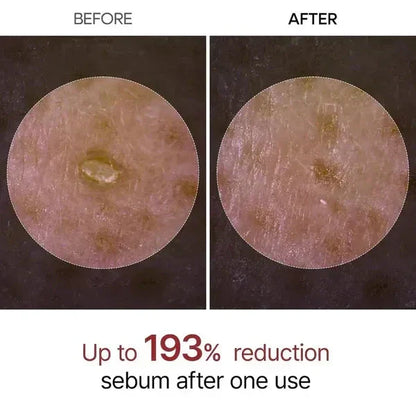 Dr. Melaxin Rice Peel Ampoule