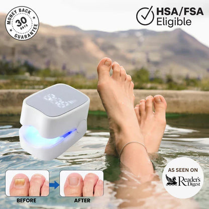 Viorra Pro™ - Nail Fungus Laser Device